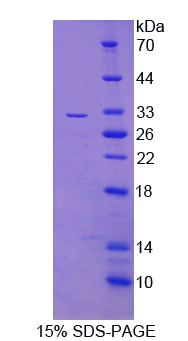 C-Ros癌基因1(ROS1)重组蛋白