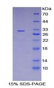LIM衰老细胞抗原样域蛋白1(LIMS1)重组蛋白