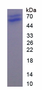 P-选择素糖蛋白配体1(PSGL1)重组蛋白