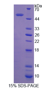 Rho GDP解离抑制因子β(ARHGDIb)重组蛋白