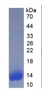 S100钙结合蛋白A6(S100A6)重组蛋白