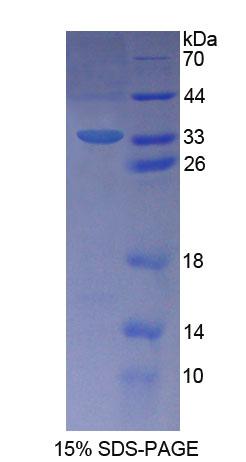 Schlafen家族成员5(SLFN5)重组蛋白