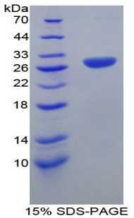 TNF受体关联因子1(TRAF1)重组蛋白