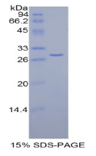 Zeste同源物增强子2(EZH2)重组蛋白