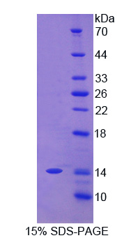 癌胚抗原相关细胞粘附分子8(CEACAM8)重组蛋白
