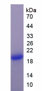 安定结合抑制因子(DBI)重组蛋白