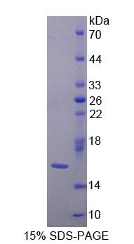 半乳糖凝集素9B(GAL9B)重组蛋白