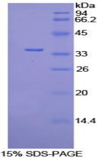 丙酮酸脱氢酶激酶同工酶4(PDK4)重组蛋白