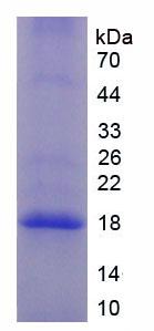 补体因子P(CFP)重组蛋白