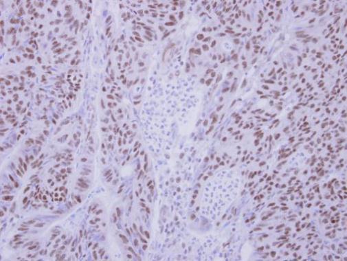 BS69 antibody