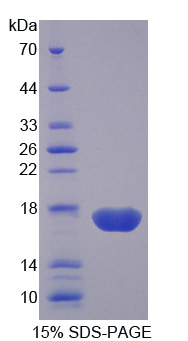 蛋白二硫化物异构酶A4(PDIA4)重组蛋白