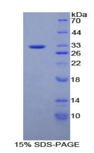 蛋白酪氨酸磷酸酶受体B(PTPRB)重组蛋白