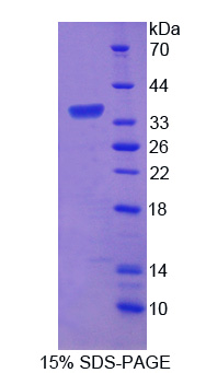 淀粉样蛋白β前体蛋白结合蛋白B3(APBB3)重组蛋白