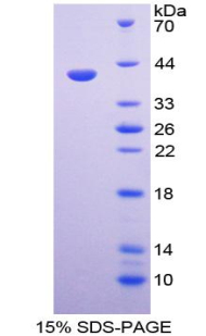 凋亡蛋白酶激活因子1(APAF1)重组蛋白