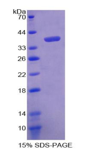 多巴胺转运蛋白(DAT)重组蛋白