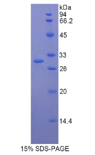 多聚蛋白1(MMRN1)重组蛋白
