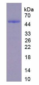 恶性脑肿瘤缺失蛋白1(DMBT1)重组蛋白