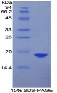 法尼基二磷酸法尼基转移酶1(FDFT1)重组蛋白