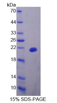 泛素表达转录因子(UXT)重组蛋白