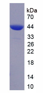 钙/钙调蛋白依赖性蛋白激酶激酶2(CAMKK2)重组蛋白