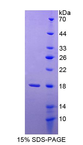 甘露糖苷酶α2B类成员1(MAN2B1)重组蛋白