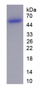 骨骼肌特异性受体酪氨酸激酶(MUSK)重组蛋白