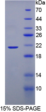 含溴区蛋白8(BRD8)重组蛋白