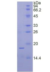 核糖核酸酶A7(RNASE7)重组蛋白