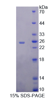 核糖核酸酶A9(RNASE9)重组蛋白