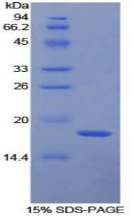 组织因子通道抑制因子(TFPI)重组蛋白