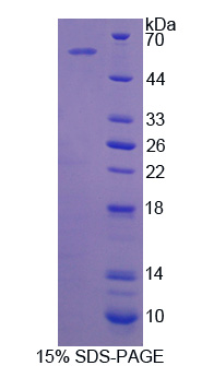 周期素依赖性激酶抑制因子3(CDKN3)重组蛋白