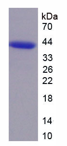 周期素依赖性激酶6(CDK6)重组蛋白