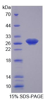 周期素依赖性激酶16(CDK16)重组蛋白