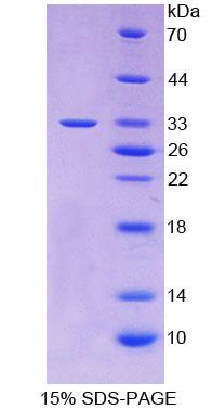 肿瘤坏死因子相关凋亡诱导配体(TRAIL)重组蛋白