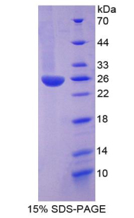 中间α-球蛋白抑制因子H3(ITIH3)重组蛋白