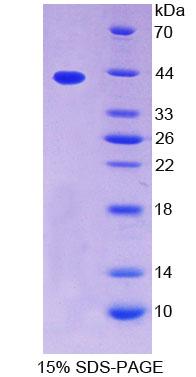 原肌球蛋白2β(TPM2)重组蛋白