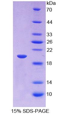 胰岛素样生长因子结合蛋白2(IGFBP2)重组蛋白