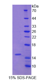 血清淀粉样蛋白A2(SAA2)重组蛋白