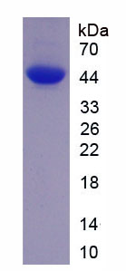 血清淀粉样蛋白A(SAA)重组蛋白