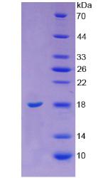 血管抑素(ANG)重组蛋白