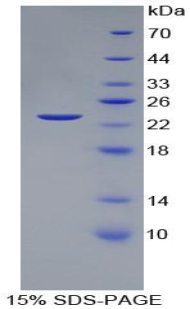 血管内皮生长因子145(VEGF145)重组蛋白