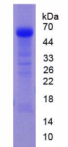 血管紧张素转化酶(ACE)重组蛋白