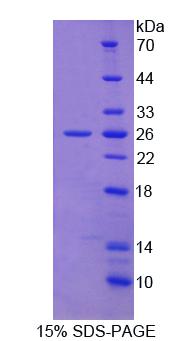 信号淋巴细胞激活分子家族成员2(SLAMF2)重组蛋白