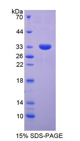信号传导转录激活因子5B(STAT5B)重组蛋白