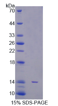 信号传导转录激活因子5A(STAT5A)重组蛋白
