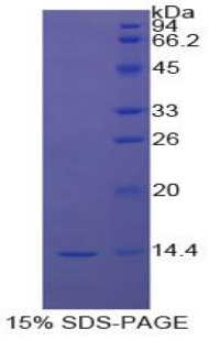 信号传导转录激活因子3(STAT3)重组蛋白