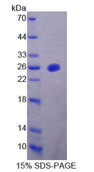 线粒体肿瘤抑制因子1(MTUS1)重组蛋白