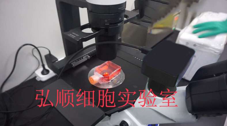 Karpas-422 Cells|人类B细胞淋巴瘤悬浮细胞