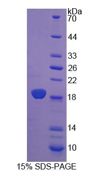 细胞维甲酸结合蛋白2(CRABP2)重组蛋白