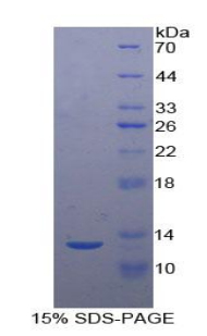 尾加压素2(UST2)重组蛋白